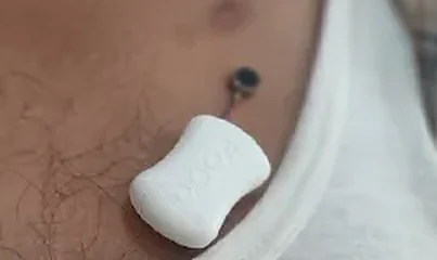 The FoGO Health chest vibrotactile module worn at the sternum